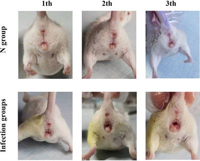 Effects of Boric Acid Gel on Vaginal Candida albicans Infections and the Local Immune System in Mice